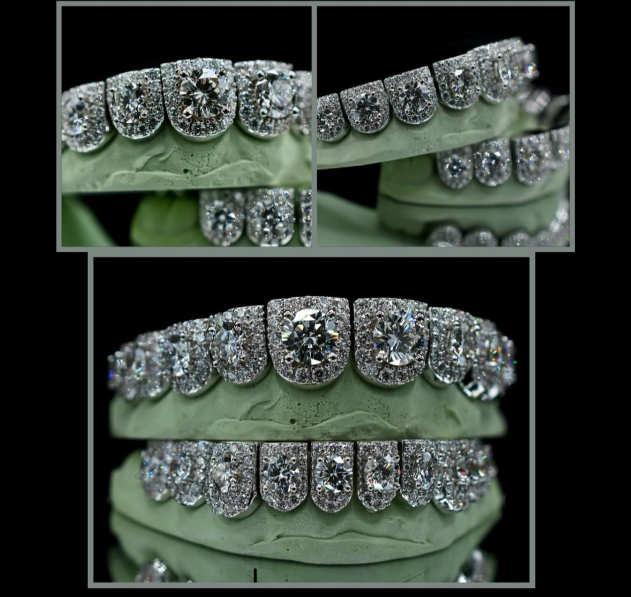 Custom diamond grillz set on dental molds, handcrafted by Ray The Jeweler & Co.