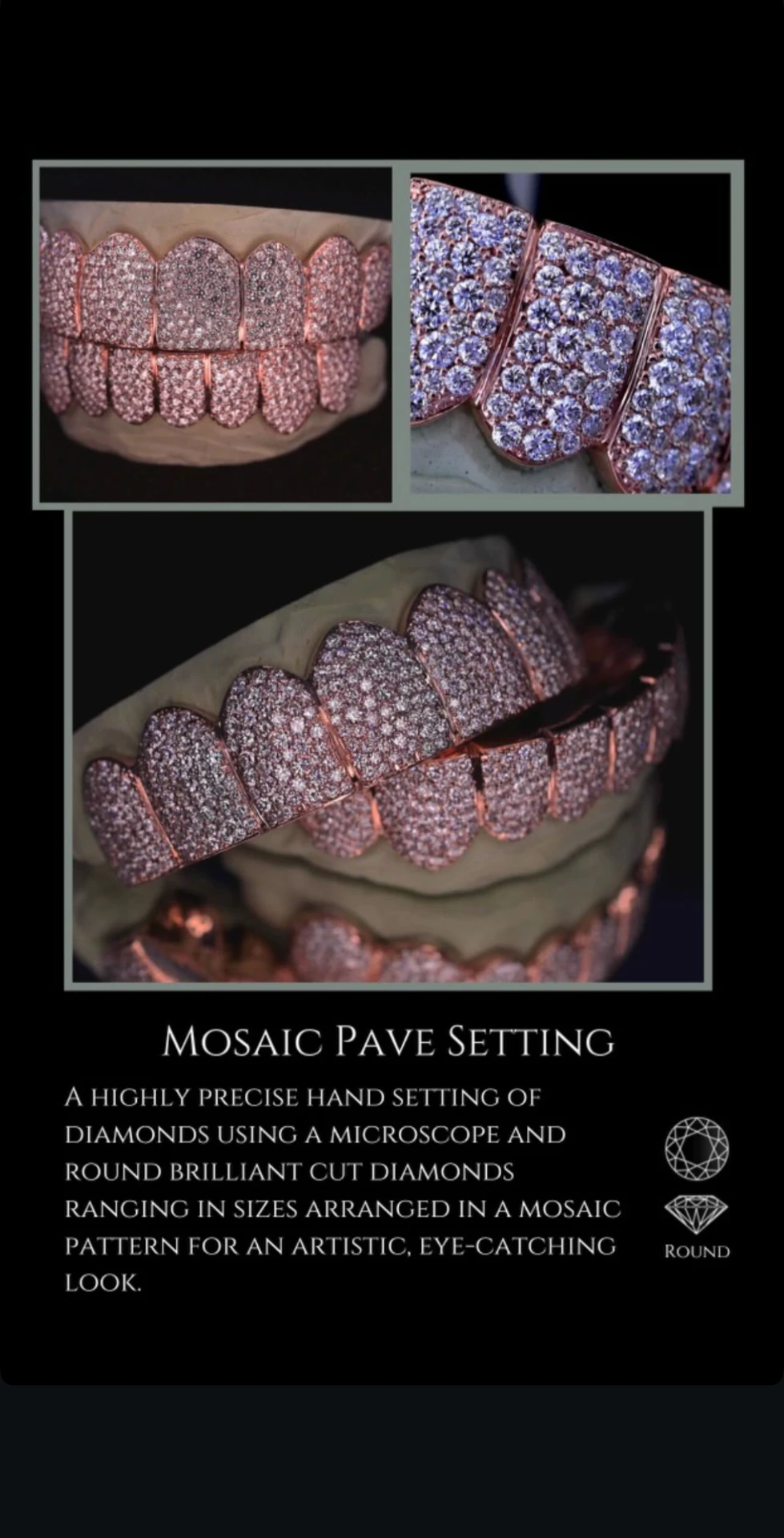 Mosaic pavé setting rose gold grillz hand-set with round brilliant diamonds