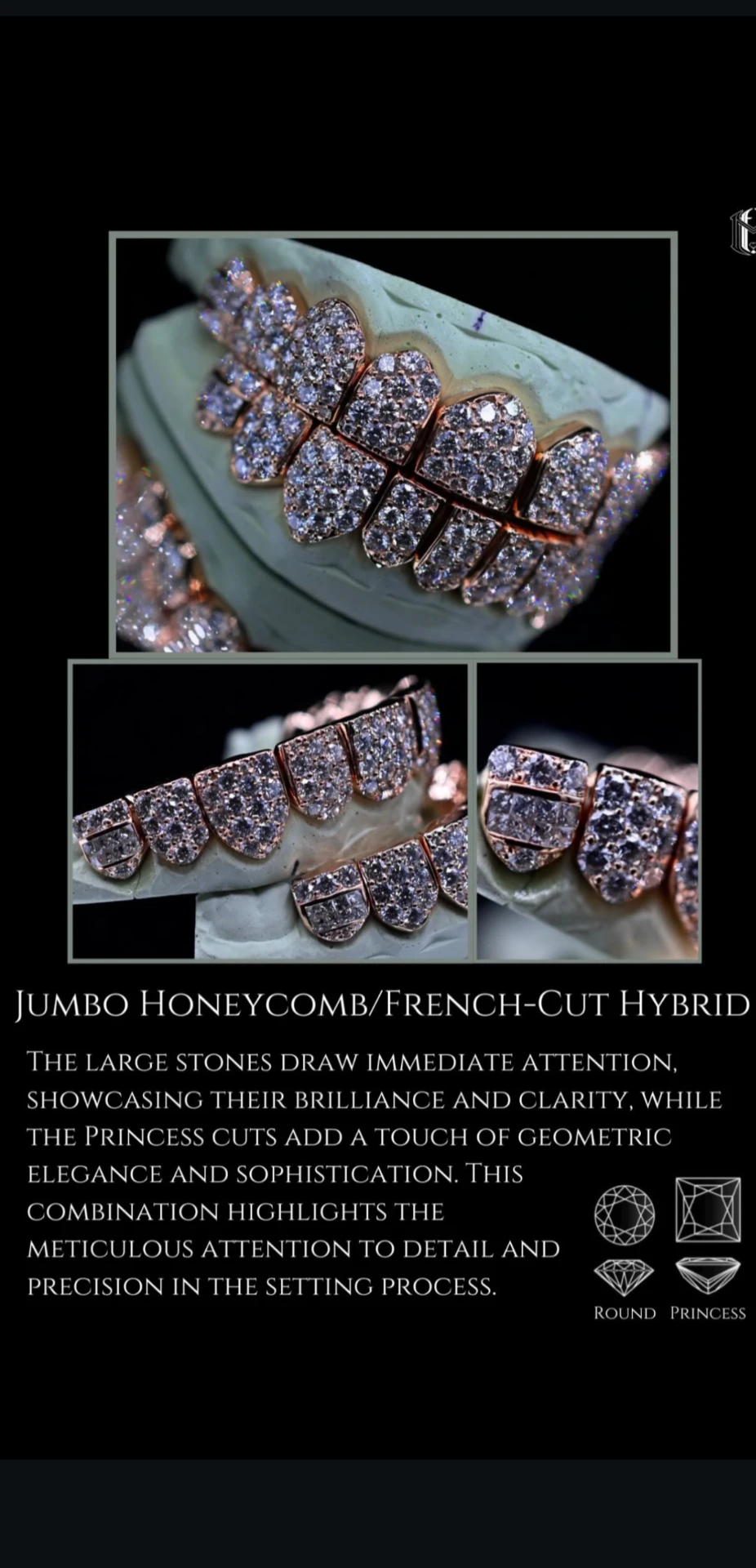 Jumbo honeycomb and French-cut hybrid rose gold grillz